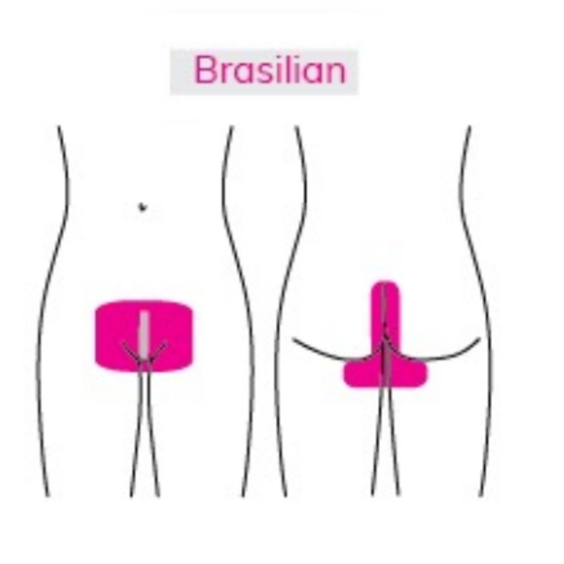 Prikaz depilacije bikini BRASILIAN