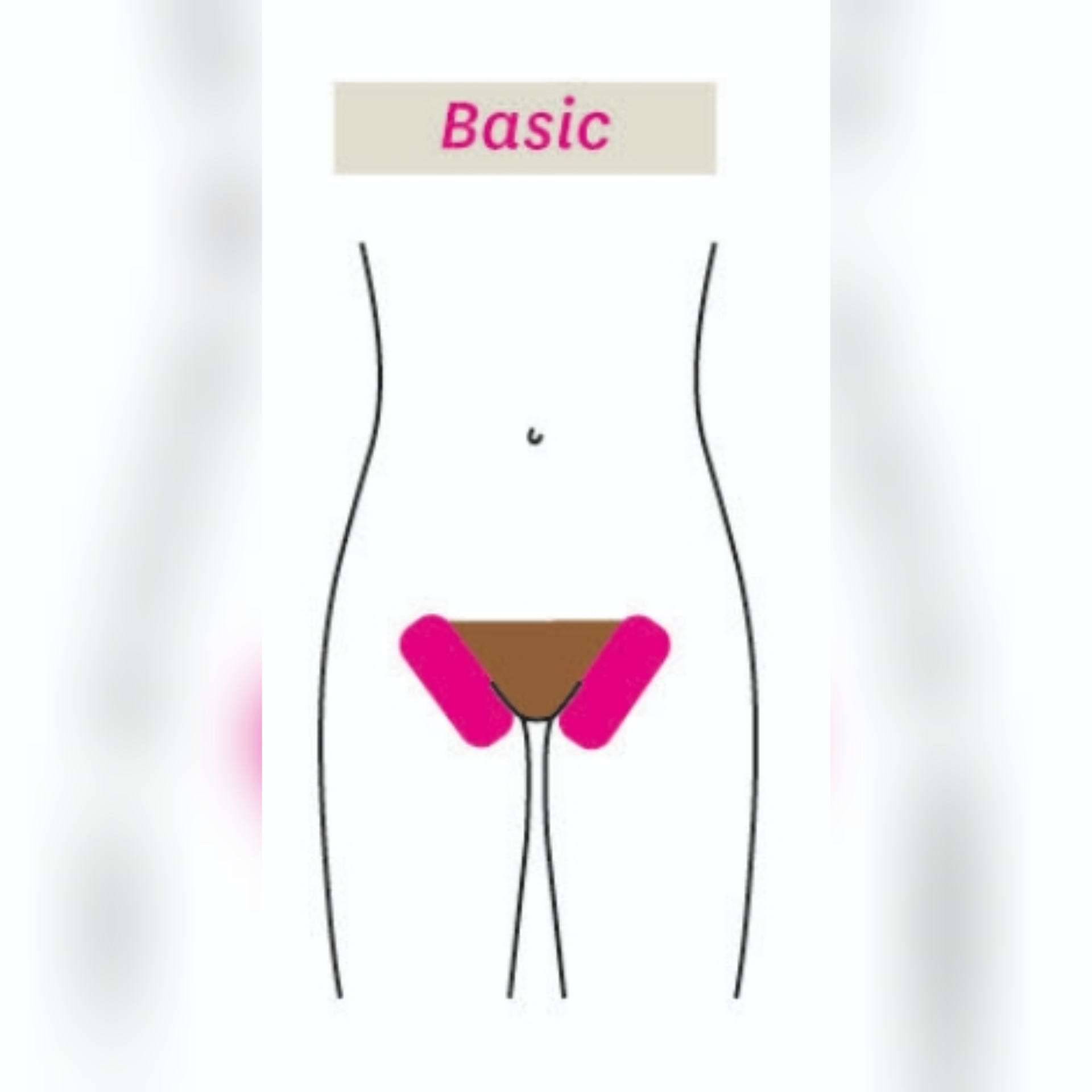 Prikaz bikini BASIC depilacije