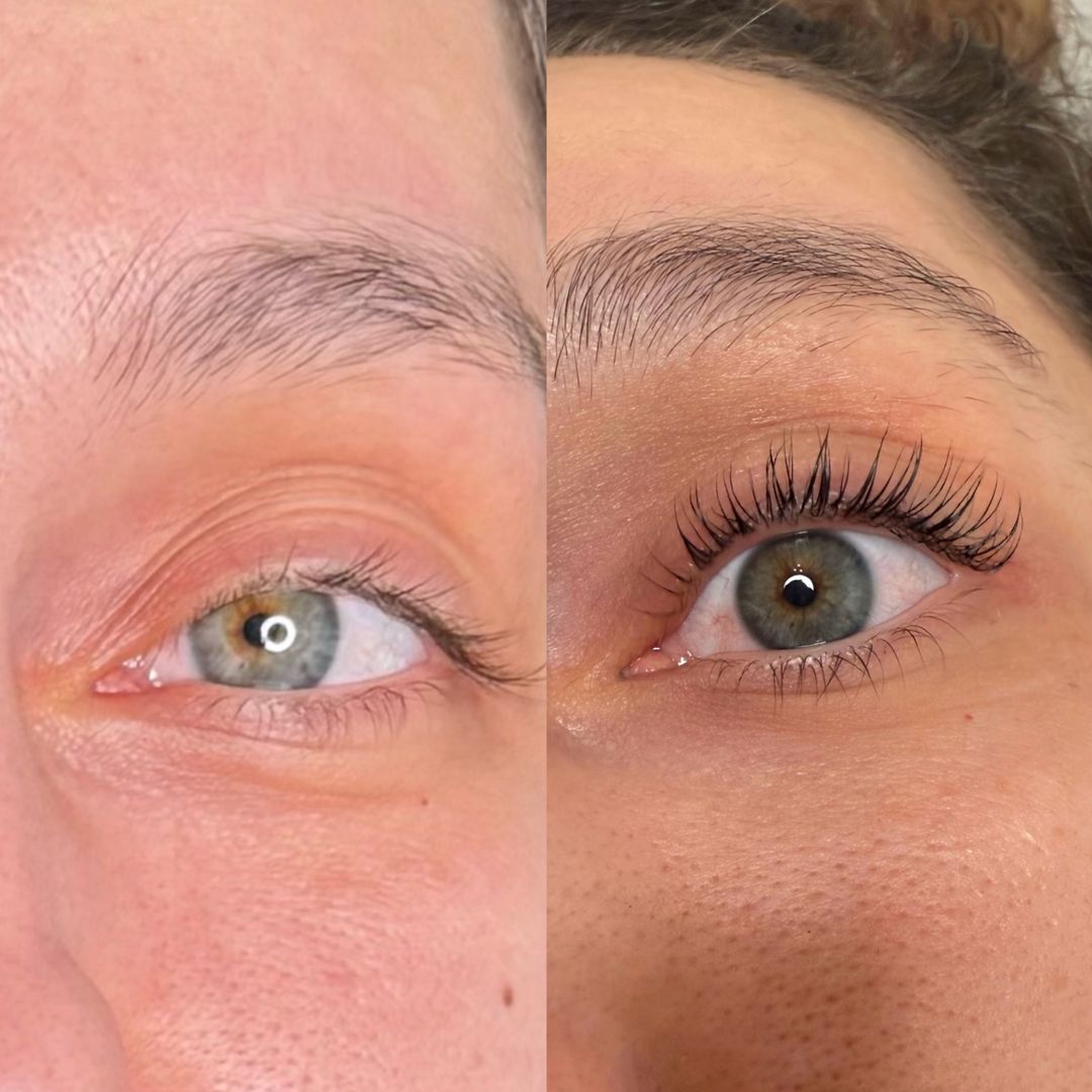 Lash lift