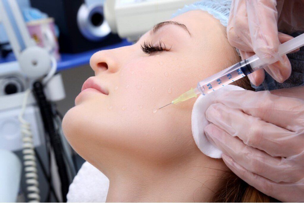 Medicinska microneedling terapija pomaže prirodnim sastojcima da prodru duboko ispod površine kože, hrane je i hidratiziraju. Mikro ubodi potiču kožu na regeneraciju čime se uklanja površinski sloj kože sa svim nepravilnostima uključujući hiperpigmentaciju i hipopigmentacijama. Uz pomoć mikro uboda aplicira se kombinacija vitamina, minerala, aminokiselina i ostalih aktivnih tvari direktno u srednji sloj kože. Kokteli aktivnih sastojaka zaustavljaju starenje kože, smanjuju bore te kožu čini sjajnom i blistavom.