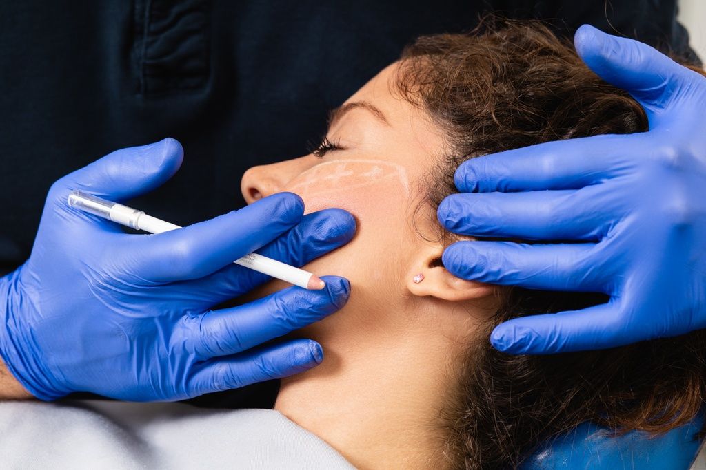 Biorevitalizatori na bazi hijaluronske kiseline potiču stvaranje kolagena i koriste se kada želimo usporiti starenje kože i pomladit je na prirodan način.
