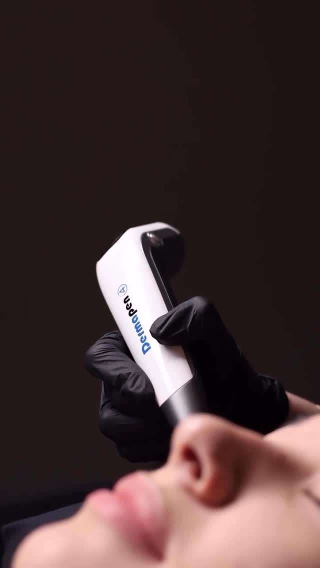 𝐃𝐞𝐫𝐦𝐚𝐩𝐞𝐧 𝟒 najnoviji je i najnapredniji uređaj za tretmane mikroiglicama koji pruža nevjerojatne rezultate u 𝐩𝐨𝐛𝐨𝐥𝐣š𝐚𝐧𝐣𝐮 𝐭𝐞𝐤𝐬𝐭𝐮𝐫𝐞 𝐤𝐨ž𝐞, 𝐬𝐦𝐚𝐧𝐣𝐞𝐧𝐣𝐮 𝐛𝐨𝐫𝐚, 𝐨ž𝐢𝐥𝐣𝐚𝐤𝐚, 𝐬𝐭𝐫𝐢𝐣𝐚 𝐢 𝐡𝐢𝐩𝐞𝐫𝐩𝐢𝐠𝐦𝐞𝐧𝐭𝐚𝐜𝐢𝐣𝐚.

Neke od dodatnih prednosti Dermapena:
🌺Zaglađivanje kože i sužavanje pora
🤍Prirodno pomlađivanje i stimulacija kolagena
🌺Bezbolnost, sigurnost i brz oporavak
🤍Brza vidljivost rezultata

Rezervirajte termin na vrijeme i zaljubite se u svoju kožu!