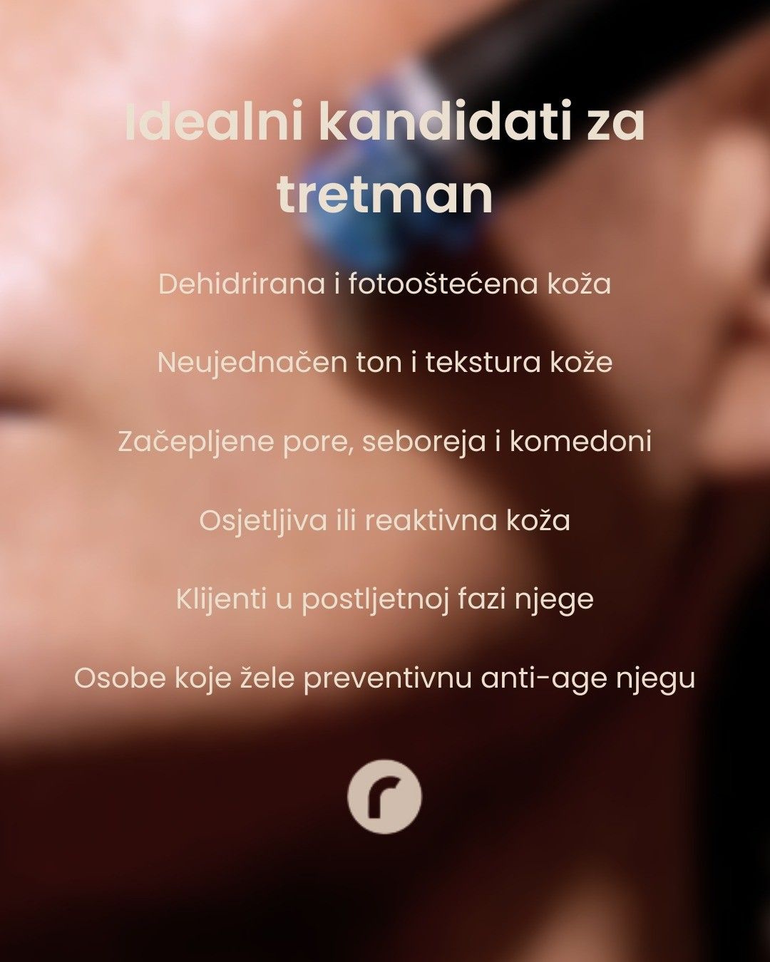 Tretman koji biramo tokom cijele godine, a posebno volimo ljeti!
𝘡𝘢š𝘵𝘰?
Osim što intenzivno 𝐡𝐢𝐝𝐫𝐚𝐭𝐢𝐳𝐢𝐫𝐚, 𝐧𝐣𝐞ž𝐧𝐨 𝐮𝐤𝐥𝐚𝐧𝐣𝐚 𝐨š𝐭𝐞ć𝐞𝐧𝐞 𝐬𝐭𝐚𝐧𝐢𝐜𝐞 𝐭𝐞 𝐫𝐞𝐯𝐢𝐭𝐚𝐥𝐢𝐳𝐢𝐫𝐚 𝐤𝐨ž𝐮 iscrpljenu suncem, morem i toplinom – vraćajući joj zdrav izgled, ravnotežu i blistavost bez iritacije.

