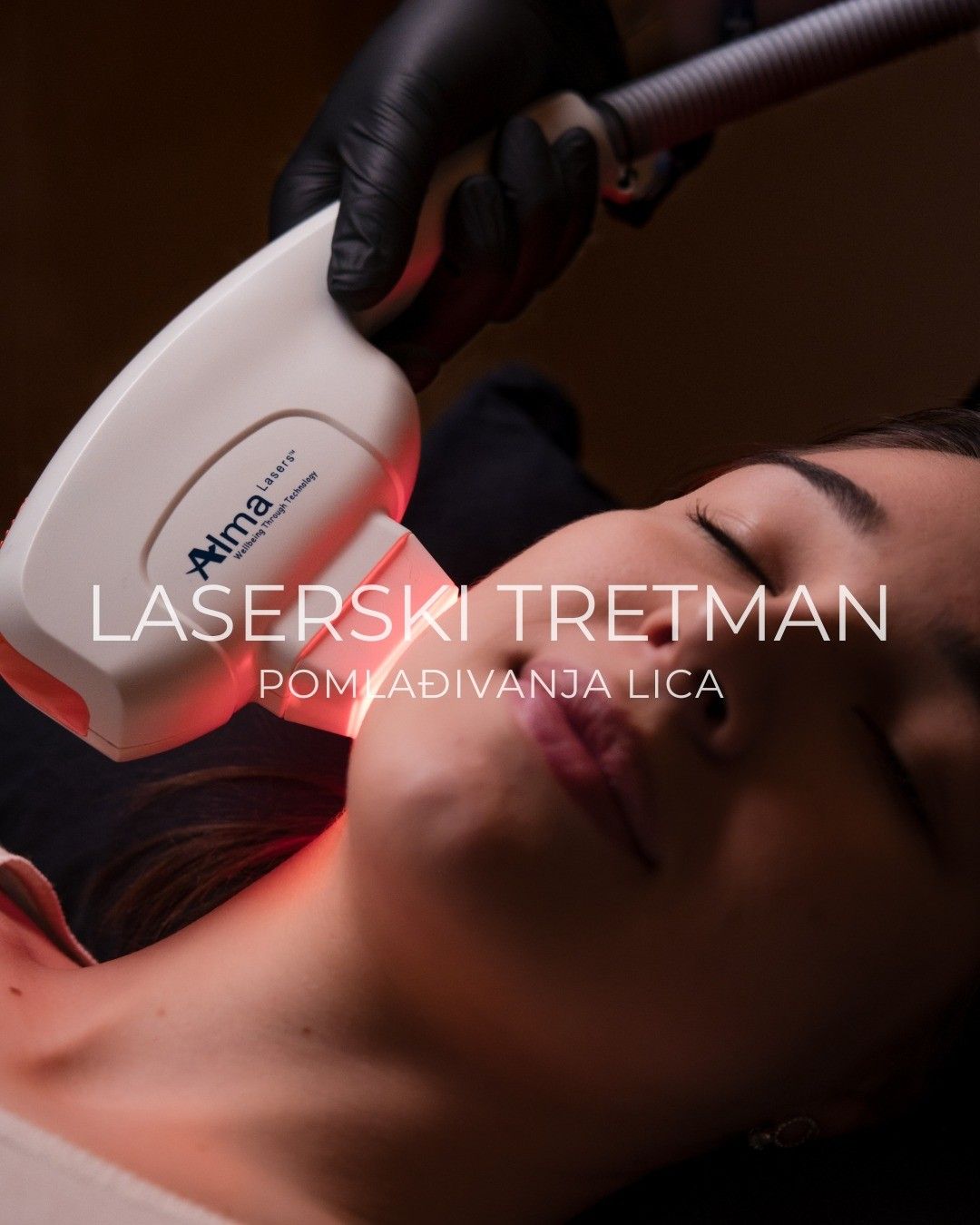 Ovaj tretman koristi 𝐧𝐚𝐩𝐫𝐞𝐝𝐧𝐮 𝐭𝐞𝐡𝐧𝐨𝐥𝐨𝐠𝐢𝐣𝐮 𝐝𝐢𝐨𝐝𝐞 𝐥𝐚𝐬𝐞𝐫𝐚 za dubinsku regeneraciju kože.
Djeluje poticanjem sinteze kolagena, poboljšava elastičnost i tonus te smanjuje sitne bore i znakove umora.
✓𝐧𝐞𝐢𝐧𝐯𝐚𝐳𝐢𝐯𝐚𝐧 ✓𝐛𝐞𝐳𝐛𝐨𝐥𝐚𝐧 ✓𝐛𝐞𝐳 𝐩𝐨𝐭𝐫𝐞𝐛𝐧𝐨𝐠 𝐨𝐩𝐨𝐫𝐚𝐯𝐤𝐚

Prepustite se rukama naših stručnjaka, pomladite i obnovite svoju kožu uz naprednu tehnologiju