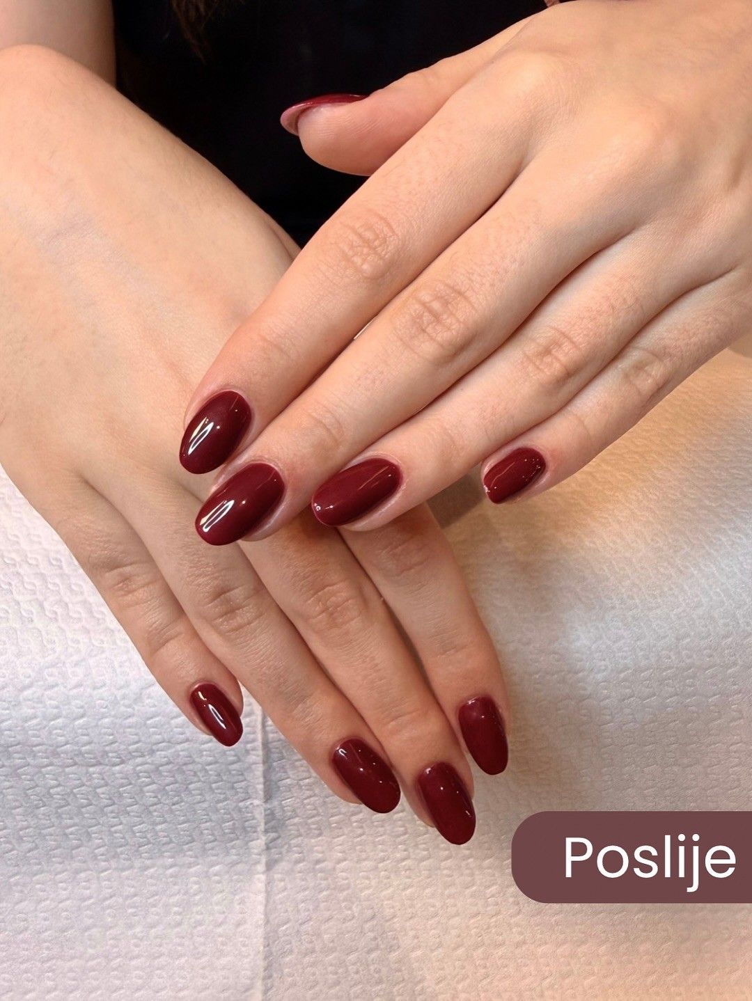𝐓𝐫𝐚𝐣𝐧𝐢 𝐥𝐚𝐤, 𝐦𝐚𝐧𝐢𝐤𝐮𝐫𝐚 𝐢 𝐩𝐞𝐝𝐢𝐤𝐮𝐫𝐚 - sve ono što ste voljeli, sada vas ponovno čeka u našem estetskom centru - Reneskins by Bagatin!

Za prekrasne rezultate, o kojima najbolje svjedoče fotografije prije i poslije, zaslužna je naša stručnjakinja Katarina, poznata po preciznosti i savršenom osjećaju za detalje.🤍

Rezervirajte svoj termin na vrijeme i priuštite si savršeno uređene nokte i trenutak potpunog opuštanja.🌺