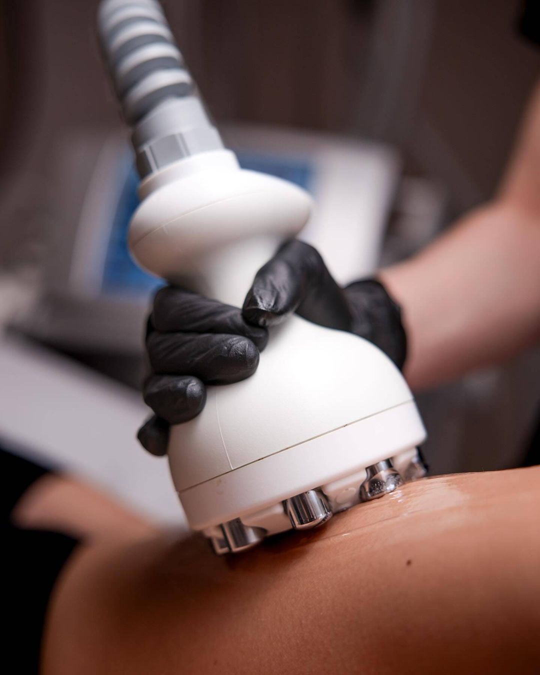 𝐕𝐞𝐧𝐮𝐬 𝐋𝐞𝐠𝐚𝐜𝐲 - moć radiofrekvencije i pulsirajućih elektromagnetskih valova!
Ovaj neinvazivni tretman potiče 𝐳𝐚𝐭𝐞𝐳𝐚𝐧𝐣𝐞 𝐤𝐨ž𝐞, 𝐬𝐦𝐚𝐧𝐣𝐞𝐧𝐣𝐞 𝐜𝐞𝐥𝐮𝐥𝐢𝐭𝐚 𝐢 𝐨𝐛𝐥𝐢𝐤𝐨𝐯𝐚𝐧𝐣𝐞 𝐭𝐢𝐣𝐞𝐥𝐚, a ciljano djeluje na najkritičnije regije, poboljšavajući tonus i stimulirajući prirodnu proizvodnju kolagena🤍

Rezervirajte svoj termin u 𝐂𝐞𝐧𝐭𝐫𝐮 𝐂𝐯𝐣𝐞𝐭𝐧𝐢 