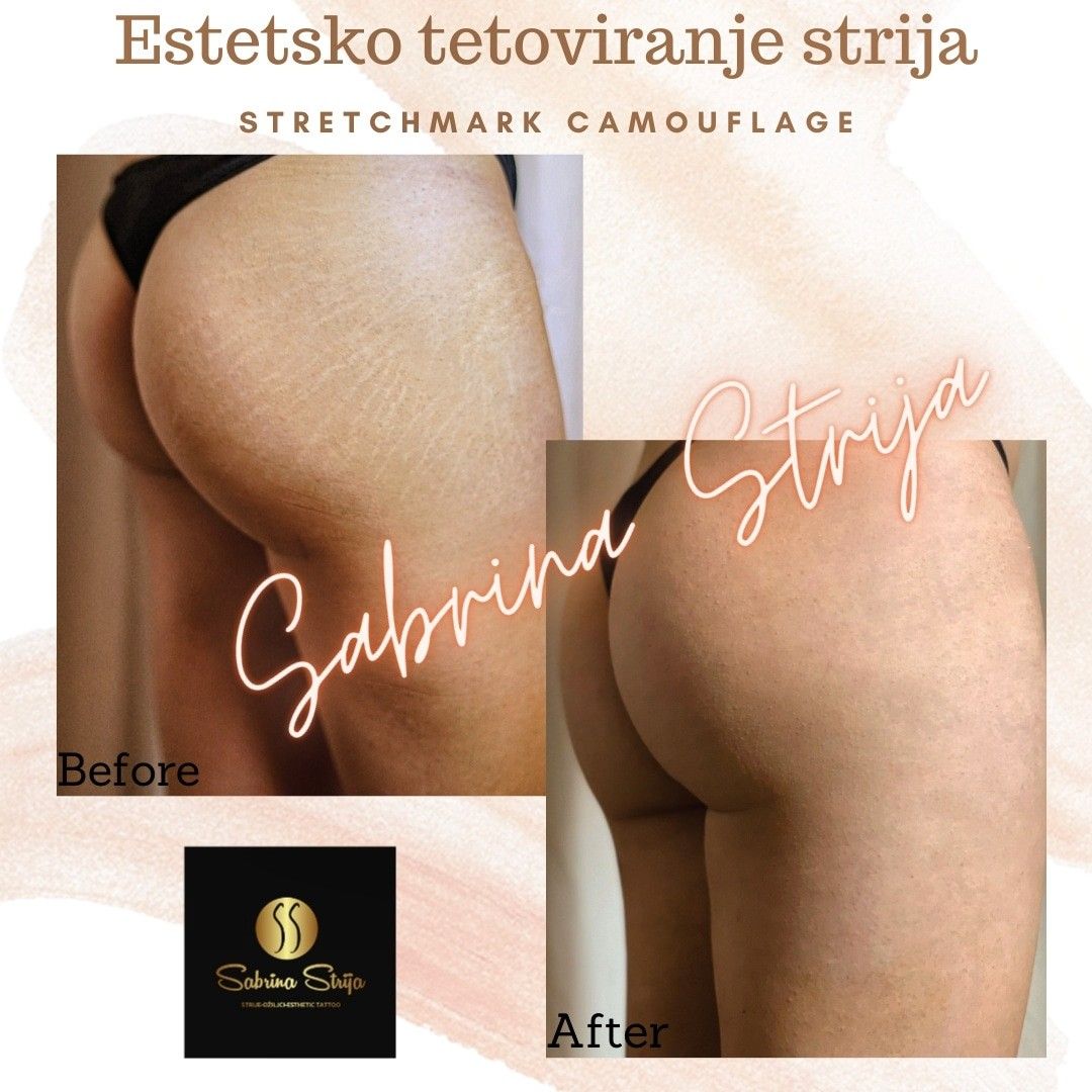 Slide 47